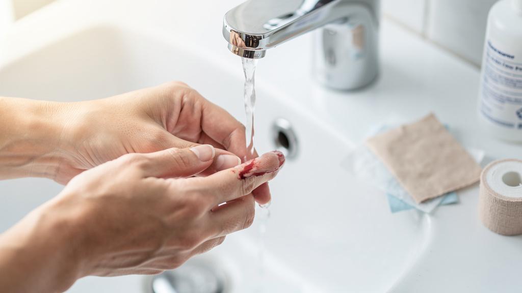 Que faire si l'ongle s'est retourné après un choc ?
